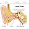 Otitis media ear disease 3d medical vector illustration on white background