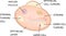 Ovarian cancer. cancer of epithelial layer,  germ cell, stromal tumors cell