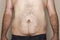 Overweight mans abdomen