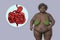 An overweight woman and close-up view of digestive system, 3D illustration