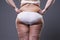 Overweight woman with fat legs and buttocks, obesity female body