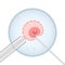 Ovum and sperm on a needle under a microscope. Artificial insemination, illustration