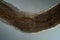 Oxiuris parasitic pinworm 100x