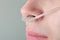 Oxygen tube in the patient\'s nose