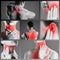 Pain in different woman`s body parts, chronic diseases of the female body, collage of several photos