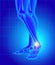 Pain and swelling on the inside of the ankle. Pain of a foot. An