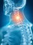 A painful cervical spine