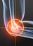 Painful elbow joint, rheumatoid arthritis, medically 3D illustration