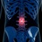A painful lumbar spine