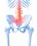 Painful lumbar spine