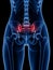 A painful sacroiliac joint