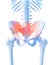 Painful sacrum