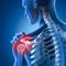 Painful shoulder joints. Frozen shoulder, Impingement. 3D illustration