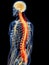 Painful spine