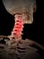 Painful spine