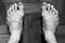 Pair of foot with veins showing [Black and White colors]