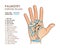 Palmistry. Hand with main and secondary lines and symbols