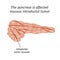 The pancreas is affected mucous intraductal tumor