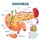 Pancreas anatomical cross section model, vector illustration medical example