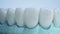 Panoramic close up view of dental implants in jaw with blue background. New white teeth are on a table in lab