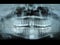 Panoramic dental radiology slide