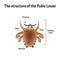 Parasitic diseases of Phthiriasis. Pediculosis pubis. Pubic lice structure. Sexually transmitted diseases. Infographics