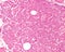 Parathyroid gland. Oxyphilic cells