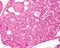Parathyroid gland. Oxyphilic cells