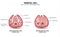 Parietal cell function