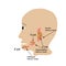 Parotid salivary gland. Submandibular salivary gland. Sublingual salivary gland. cyst. Vector illustration on isolated