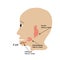 Parotid salivary gland. Submandibular salivary gland. Sublingual salivary gland. cyst. Vector illustration on isolated
