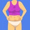 Part of Female Body, Woman Clamping Fold of Fat Belly with Both Hands, Human Figure After Weight Loss, Obesity and