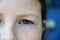 A part of girl`s face with Freckled cheek and blue eye