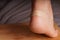 Patch, bandage or medical plaster on the skin of a woman`s foot, selective focus