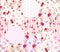 Patchwork seamless pattern from hexagon patches with floral and polka dot ornament. Romantic print with beautiful flowers