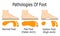 Pathologies of foot