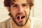 Patient with attentive face holds capsule in his teeth