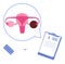 Patient diagnosis result of ovarian cyst