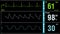 Patient monitor displays medical exam vital signs