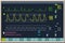 Patient monitor showing vital signs ECG and EKG. Vector illustration