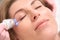 Patient undergoes an effective rejuvenating procedure radio wave face lifting