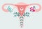 PCOS - Anatomical scheme of Uterus in flowers. Polycystic ovary syndrome - Diagram of reproductive system. Women health