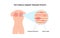 Pectoralis muscle trigger point