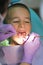 Pediatric dentist examining a little boys teeth in the dentists chair at the dental clinic. Close up of dentist examination little