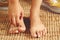 People with foot fungus in the early stages will feel itchy feet. and symptoms are more pronounced as the fungus spreads. Dry,