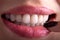 Perfect Close Up Sensual beautiful sexy Seductive Pink  Lips woman smile with tongue . White Teeth bleaching ceramic crowns