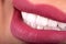 Perfect Close Up Sensual sexy Seductive Plump Lips woman smile . White beautiful Teeth bleaching ceramic crowns whitening young
