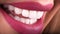 Perfect Close Up White beautiful Veneers Teeth bleaching crowns whitening young lady smiling, Sensual sexy Seductive plump Lips