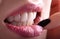 Perfect Close Up White beautiful Veneers Teeth bleaching crowns whitening young lady smiling, Sensual sexy Seductive plump Lips