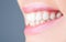 Perfect healthy teeth. Closeup shot of woman's toothy smile. Perfect healthy teeth smile woman. Teeth Whitening. Dental